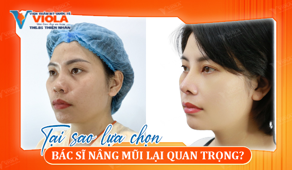 tai-sao-lua-chon-bac-si-nang-mui-lai-quan-trong