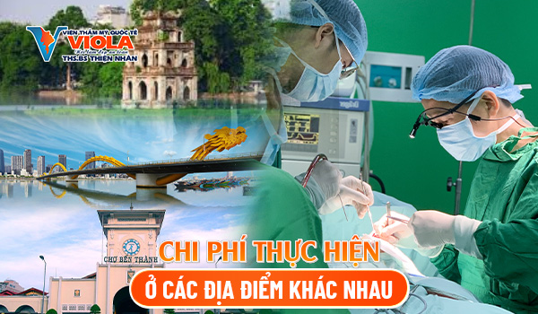 chi-phi-thuc-hien-o-cac-dia-diem-khac-nhau