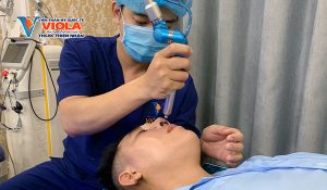 Xu hướng nâng mũi năm 2026, đẹp tự nhiên và không lộ dấu vết 3 chieu-tia-plasma-de-giam-xung