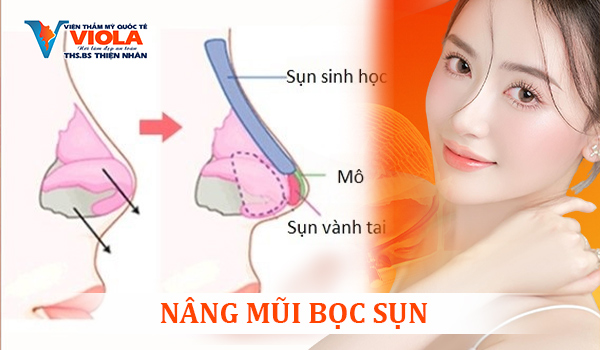 nang-mui-boc-sun