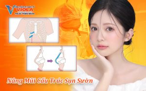 nang-mui-cau-truc-sun-suon