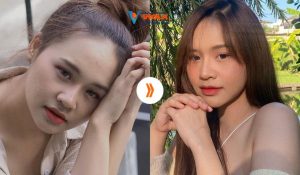 Địa chỉ nâng mũi Đà Nẵng uy tín chuẩn y khoa, không biến chứng, mũi đẹp tự nhiên 2 Kết quả thẩm mỹ đẹp tự nhiên