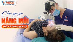 Địa chỉ nâng mũi uy tín, an toàn không nên bỏ qua tại Đà Nẵng 5 cham-soc-sau-nang-mui-giu-ve-sinh-sach-se