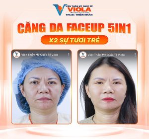 ket-qua-cang-da-faceup