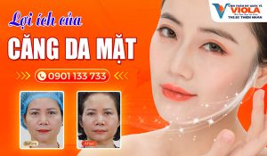 loi-ich-cua-cang-da-mat