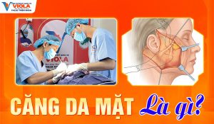cang-da-mat-la-gi