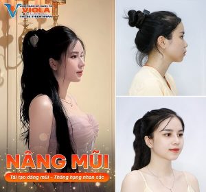 ket qua nang mui bio fast plus