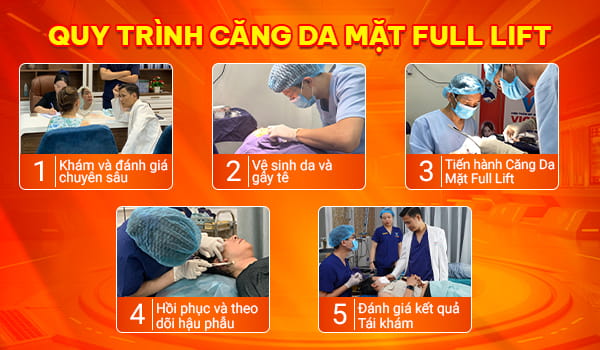Căng Da Mặt Full Lift 3 quy trinh cang da mat tai da nang
