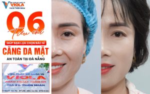 6 tieu chi giup ban lua chon bac si cang da mat dep an toan tai da nang