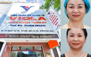 5 lưu ý cần biết để chọn địa chỉ căng da mặt an toàn tại Đà Nẵng 5 Dia chi cang da uy tin va an toan nhat da nang 2025 1