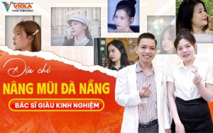 Dia chi nang mui da nang uy tin 1