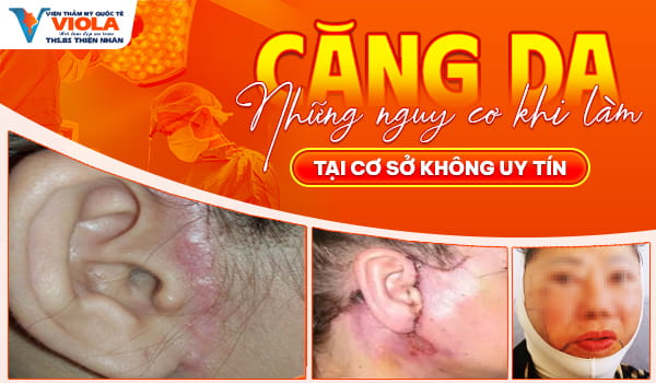 Căng da ở đâu tốt tại Đà Nẵng? Khách hàng review thực tế 2 Nhung nguy co khi lam cang da tai nhung noi khong uy tin 1