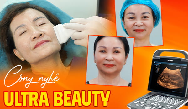 5 tiêu chí bạn cần biết khi tìm địa chỉ căng da mặt tại Đà Nẵng 3 cang da mat an toan tai da nang 1