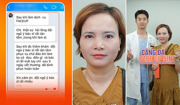 ThS.BS Thiện Nhân - Bác sĩ căng da mặt Đà Nẵng kinh nghiệm trên 20 năm 4 khach hang cang da mat da nang 1