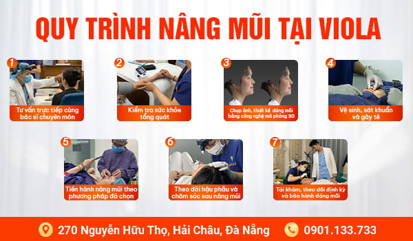 Quy trình nâng mũi Đà Nẵng đạt chuẩn y khoa tại Viện Thẩm Mỹ Quốc Tế Viola 2 quy trinh nang mui da chuan y khoa tai da nang 1 1