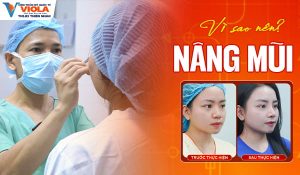 Địa chỉ nâng mũi đẹp, uy tín, chuẩn y khoa tại Đà Nẵng 2 vi-sao-nen-nang-mui