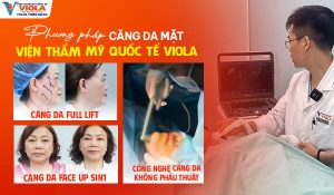 phuong-phap-cang-da-mat-tai-vien-tham-my-quoc-te-Viola