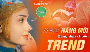 Nâng mũi Đà nẵng - Sở hữu dáng mũi đẹp chuẩn TREND 2 ky-thuat-nang-mui-dang-dep-chuan-trend