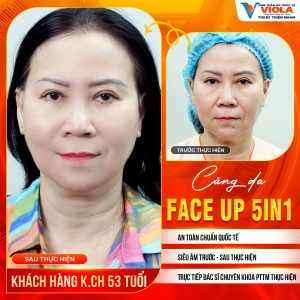 phau thuat cang da da nang 1 1