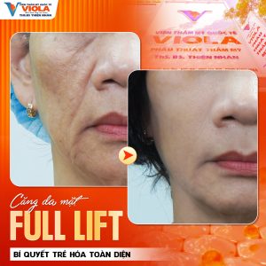 phau thuat cang da da nang 1 22