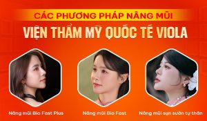 Nâng mũi bằng sụn tự thân hay nhân tạo? So sánh hiệu quả nâng mũi Đà Nẵng 2 cac phuong phap nang mui da nang tai vien tham my quoc te viola