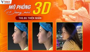mo-phong-3D-cac-dang-mui-pho-bien