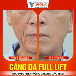 phau thuat cang da da nang 2 17 1