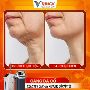 phau thuat cang da da nang 2 23 1