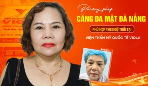 phuong-phap-cang-da-mat-da-nang-phu-hop-theo-do-tuoi-tai-vien-tham-my-quoc-te-viola