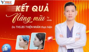 ket qua nang mui tu nhien do ThS.BS Thien Nhan thuc hien