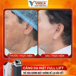 phau thuat cang da da nang 1 21