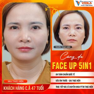 phau thuat cang da da nang 1 9