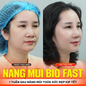 Nang Mui Tai Da Nang 2 4 1