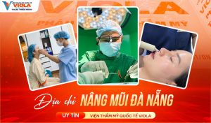 Nâng mũi Đà Nẵng cân chỉnh theo tỉ lệ gương mặt 4 dia-chi-nang-mui-da-nang-uy-tin-vien-tham-my-quoc-te-viola