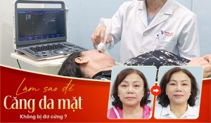 Căng da mặt Đà Nẵng trẻ hóa không lộ dấu vết thẩm mỹ 3 lam-sao-de-cang-da-mat-khong-bi-do-cung