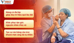 Địa chỉ căng da mặt Đà Nẵng ứng dụng kỹ thuật nâng cơ đa lớp 2 nang-co-da-lop-giup-duy-tri-hieu-qua-lau-dai