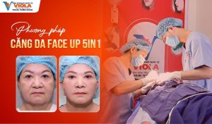 phuong phap cang da face up 5in1