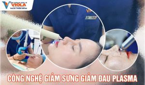 Địa chỉ nâng mũi Đà Nẵng ở đâu đẹp? Review chi tiết từ A-Z 2 cong-nghe-giam-sung-dau-plasma