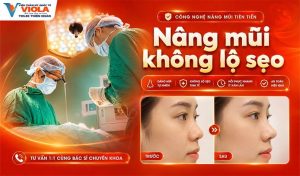 nang-mui-khong-lo-seo