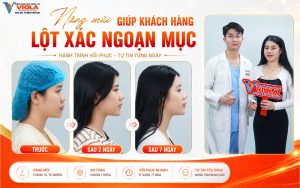nang-mui-giup-khach-hang-lot-xac-ngoan-muc