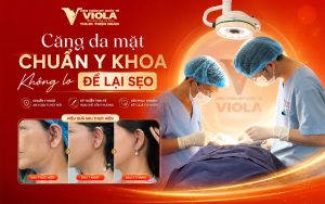 Căng da mặt Đà Nẵng ở đâu an toàn và không để lại sẹo? 3 cang-da-mat-chuan-y-khoa-khong-lo-de-lai-seo