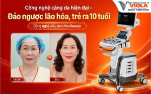 cong-nghe-cang-da-hien-dai-dao-nguoc-lao-hoa-tre-ra-10-tuoi