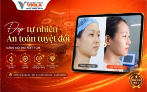 Đừng bỏ qua địa chỉ nâng mũi Đà Nẵng đạt chuẩn y khoa, đẹp tự nhiên 3 dep-tu-nhien-an-toan-tuyet-doi