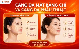 Căng da mặt Đà Nẵng: Nên chọn căng chỉ hay phẫu thuật? 3 cang-da-mat-bang-chi-hay-cang-da-phau-thuat