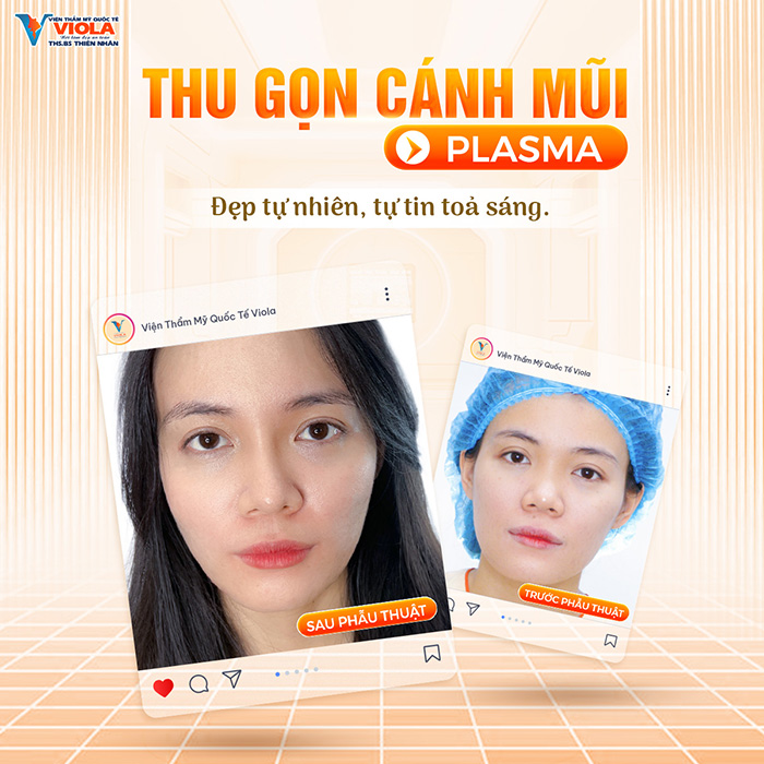 thu-gon-canh-mui-plasma