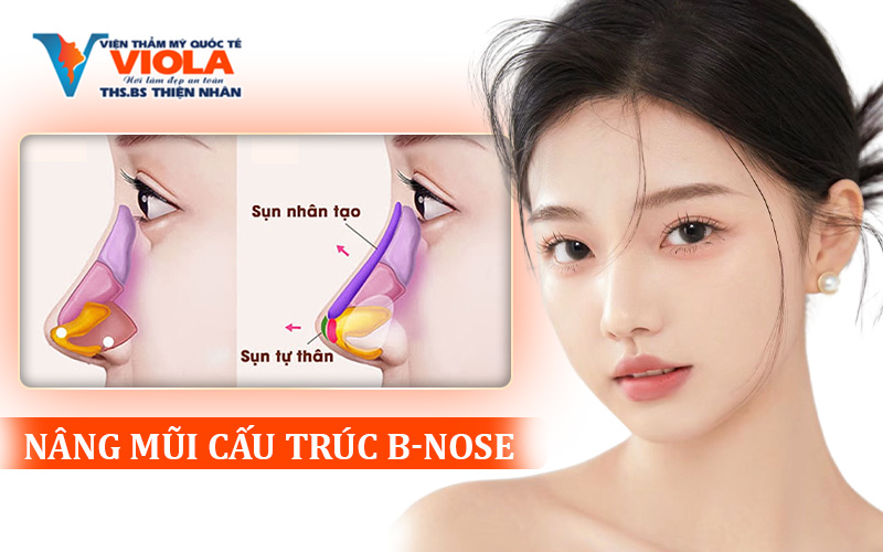 nang-mui-cau-truc-b-nose