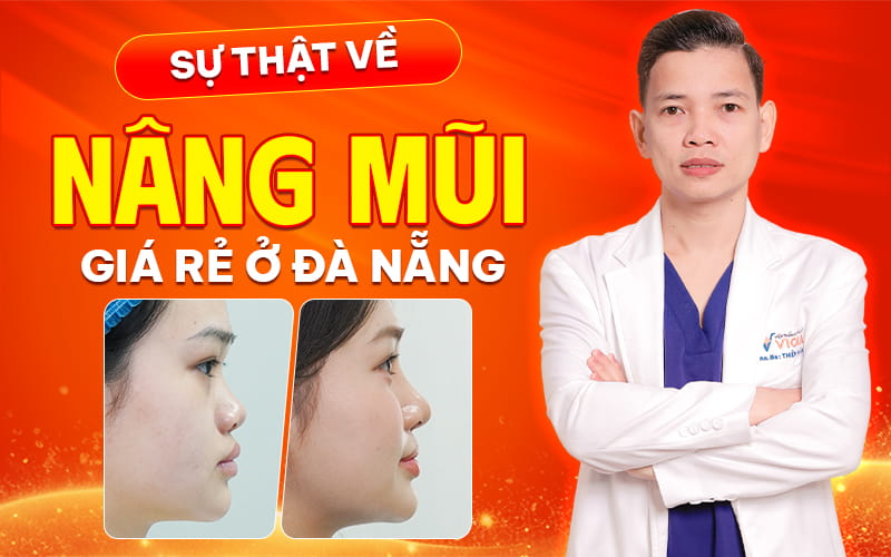 Su that ve nang mui gia re o da nang 1