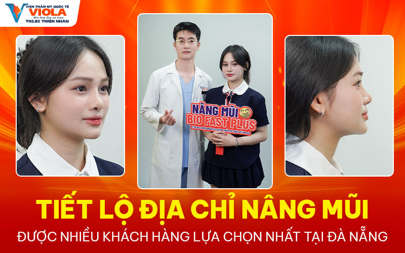 Tiet lo dia chi nang mui da nang