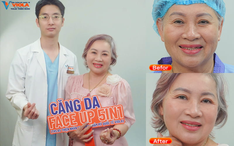 Cang da mat da nang phuong phap tre hoa khong de lai seo 1