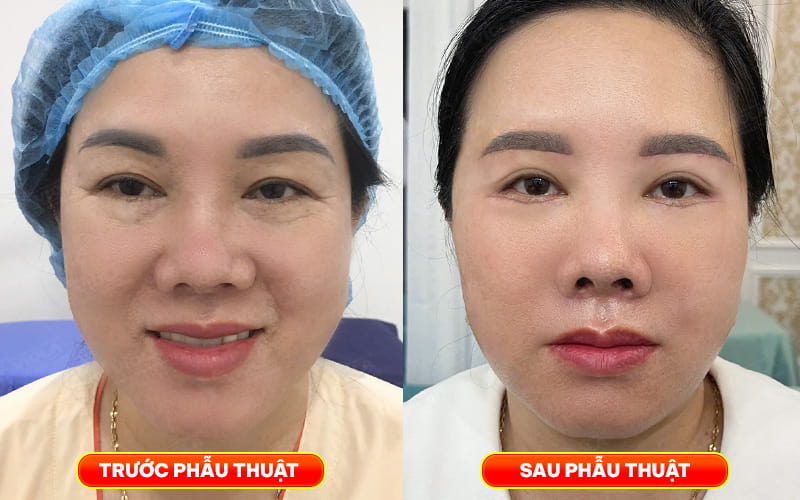 cang da mat co tot khong giai dap tu chuyeng gia